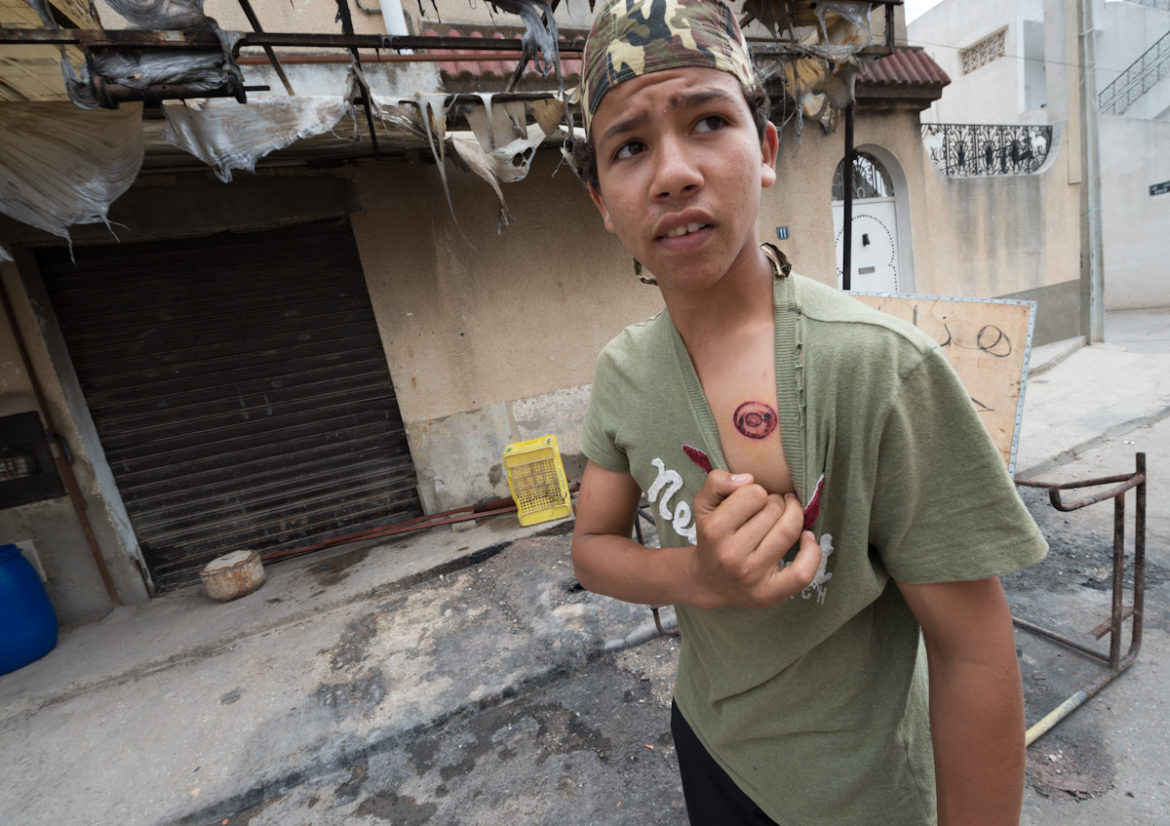 Un jeune tunisien bléssé par une grenade lacrymogène